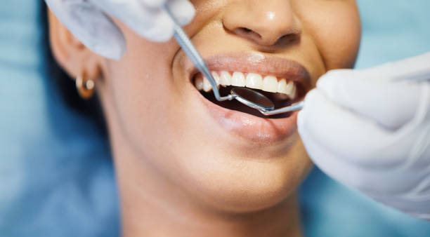Best Emergency Dental Extractions in Ball, LA